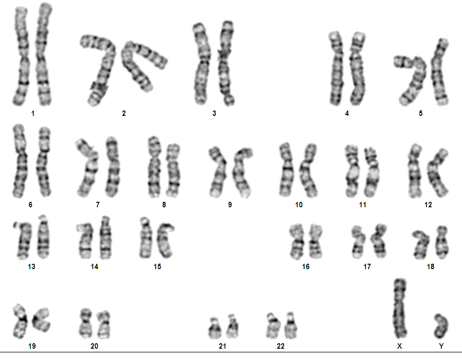 细胞染色体核型分析